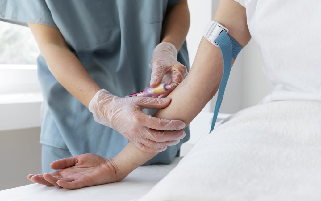 Аналіз крові на коритизол