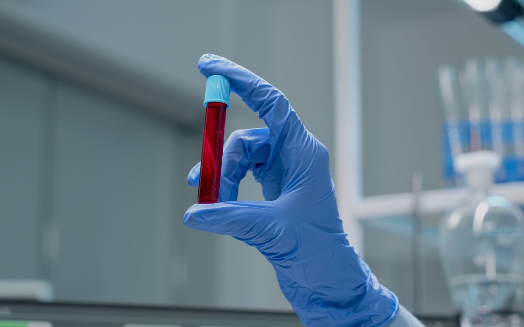 Пробірка з кров'ю