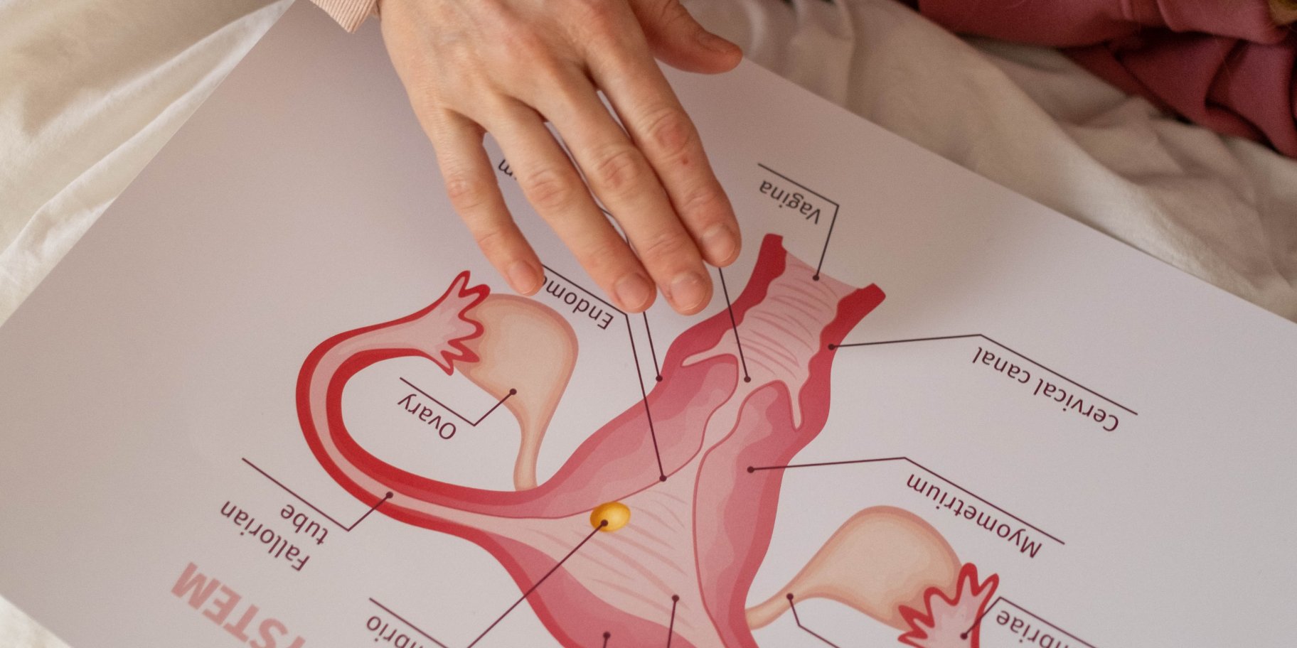 що краще їсти при ендометріозі