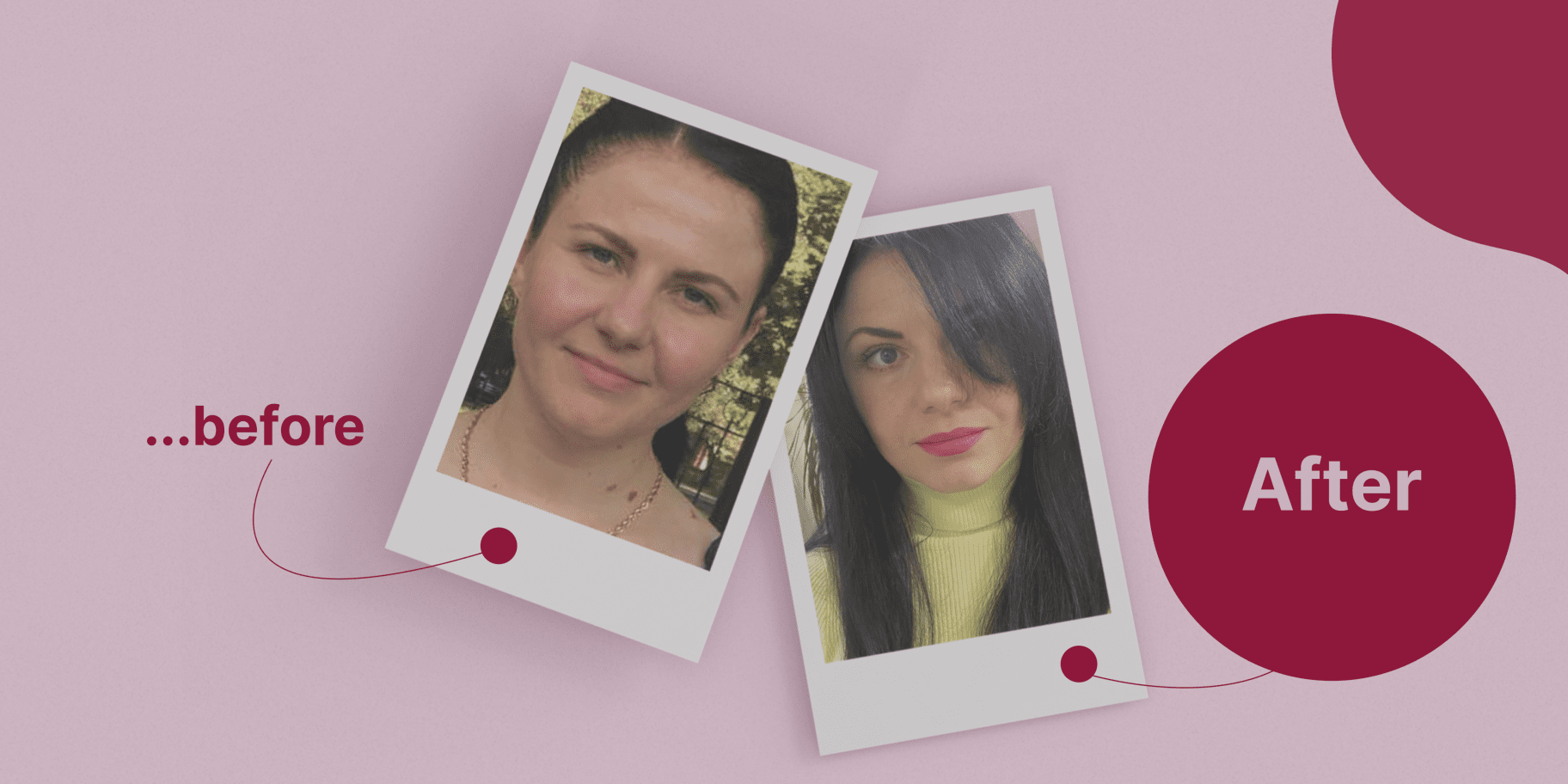 історія схуднення фото До та Після