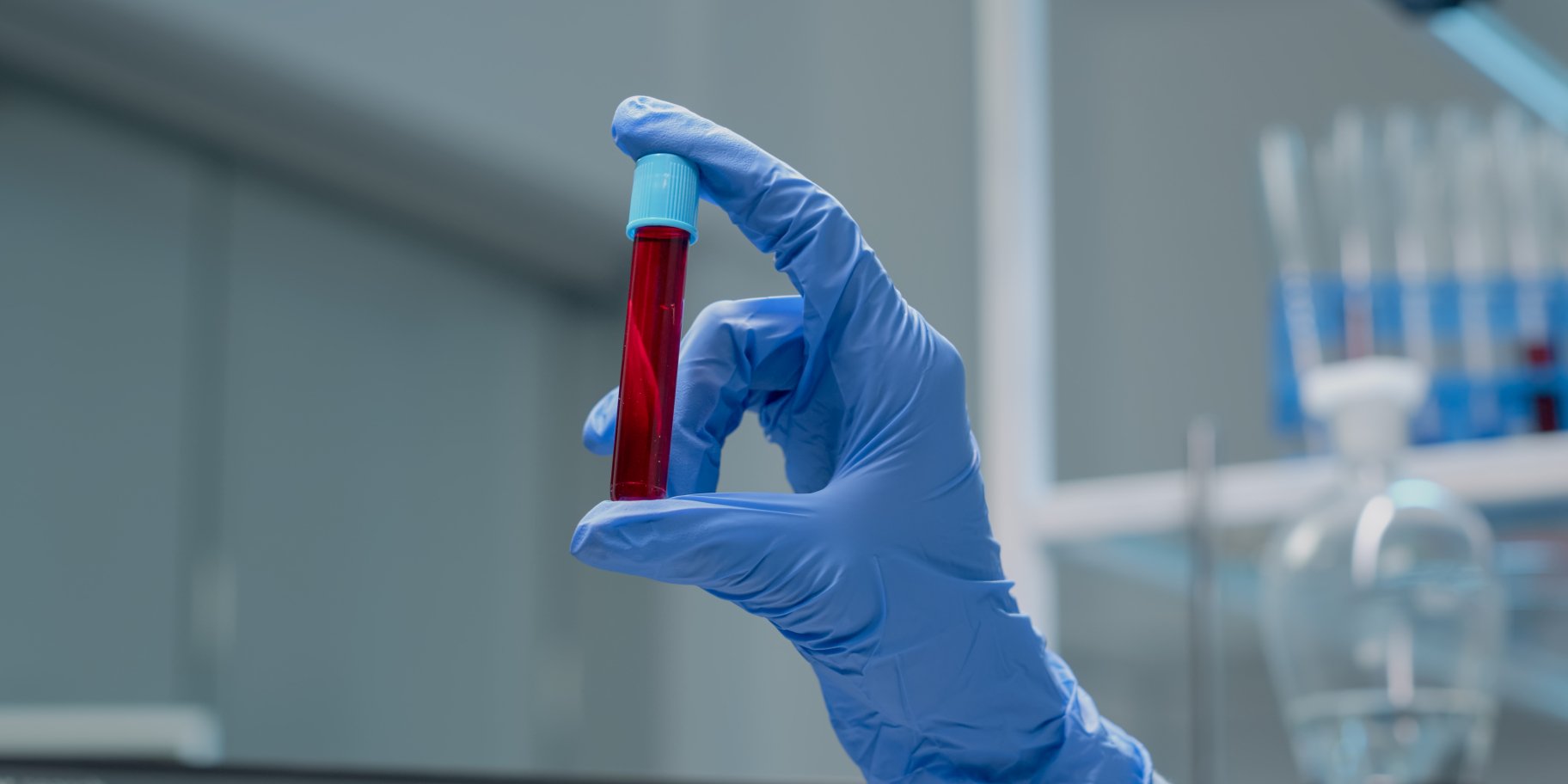 Пробірка з кров'ю