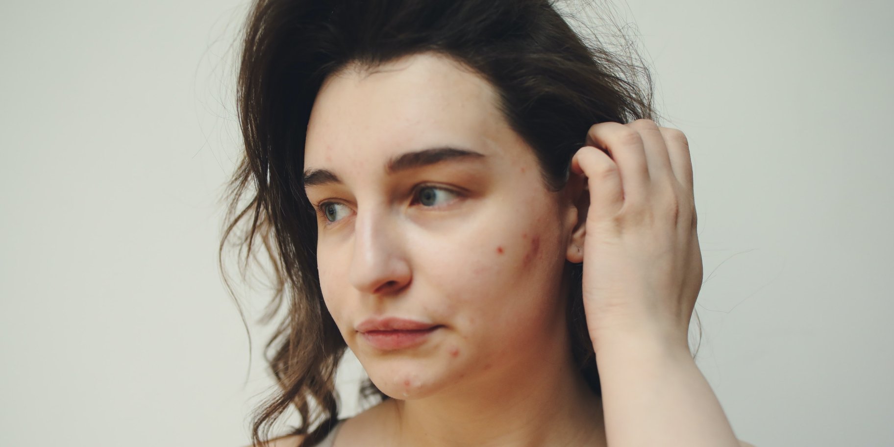 чи можна алкоголь при псоріазі