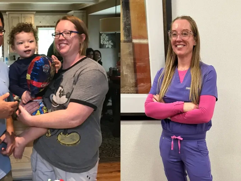 Бетсі Гранч до&nbsp;і&nbsp;після схуднення. Джерело фото: businessinsider.com