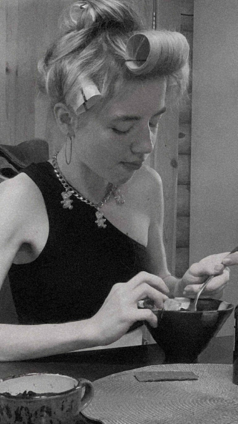 Соня у&nbsp;період боротьби з&nbsp;анорексією